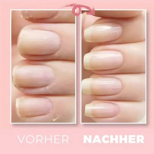 02_Kollektionen/INSIDE Unterschiede/nägel.jpg